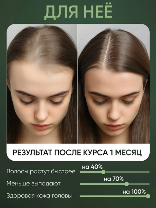 NIFEISHI, Soch uchun rozmarin yog'i Organik, soch o'sishi uchun, 30,60,120ml, 3 turdagi