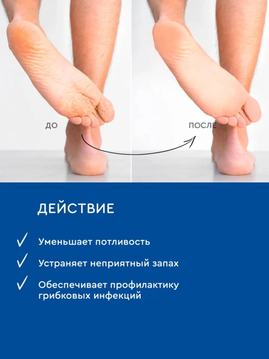 Лосьон подсушивающий при гипергидрозе INKI, 100 мл
