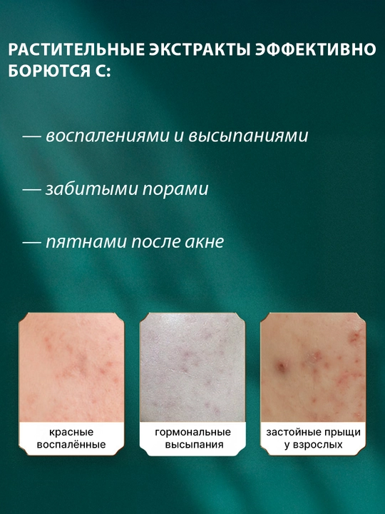 Крем для лица против акне