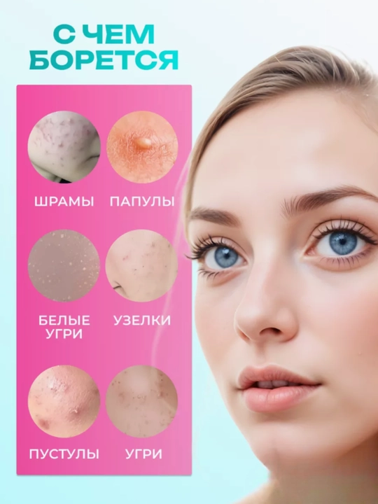 Патчи от прыщей на лице Patch Acne, гидроколлоидные, 36, 180 шт