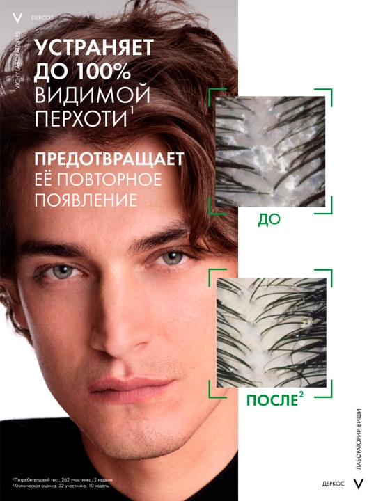 Vichy Dercos Против перхоти DS Интенсивный увлажняющий шампунь-уход 2 в 1, 200 мл