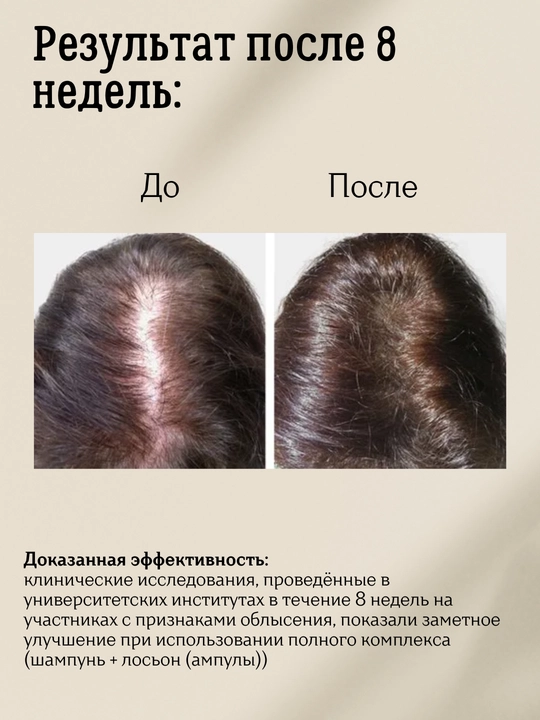 Набор против выпадения волос, Anti-hair loss, шампунь и ампулы