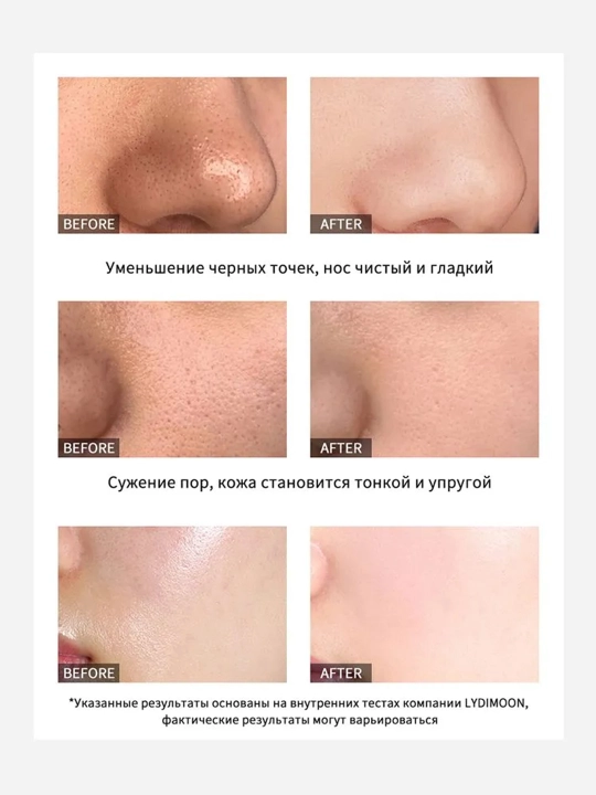 LYDIMOON черная маска для лица, 60 г