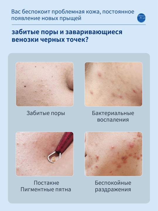 Гель от прыщей и акне, точечный крем для проблемной кожи лица, 20 мл