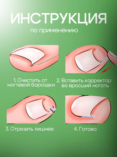Корректор и вставки для коррекции вросшего ногтя, набор кюретка и подушечки