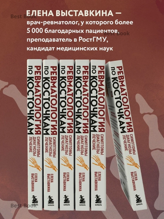 Revmatologiya po kostochkam, Simptomy, diagnozy, lecheniye, Yelena Vystavkina