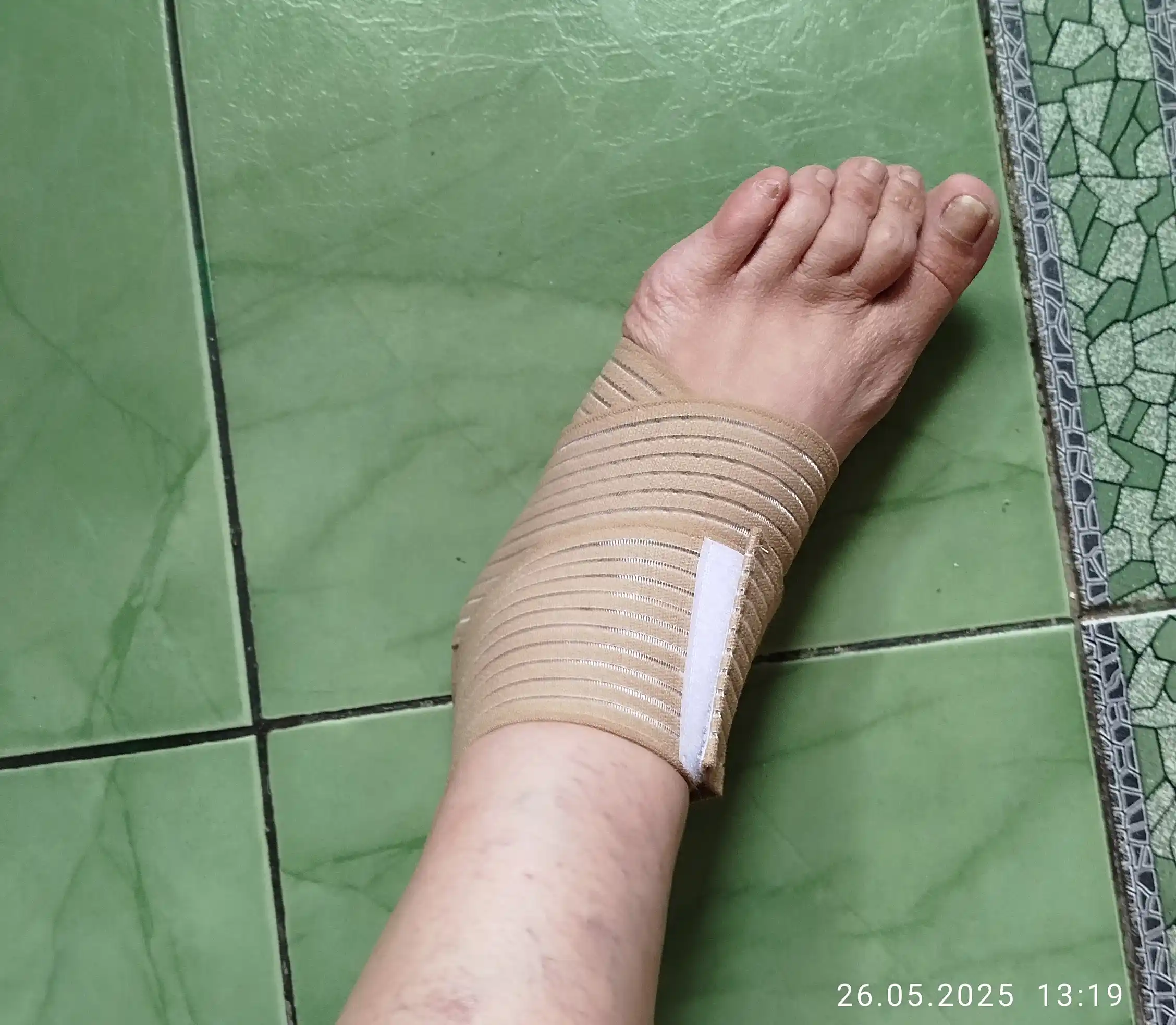 Elastik bandaj
