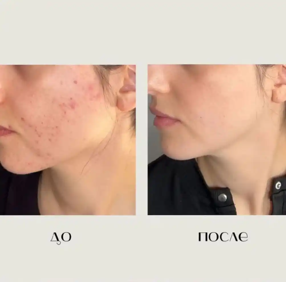 Крем для лица Dr.Althea 345 relief восстанавливающий, aqua, с PDRN, melaclear, reju 5000