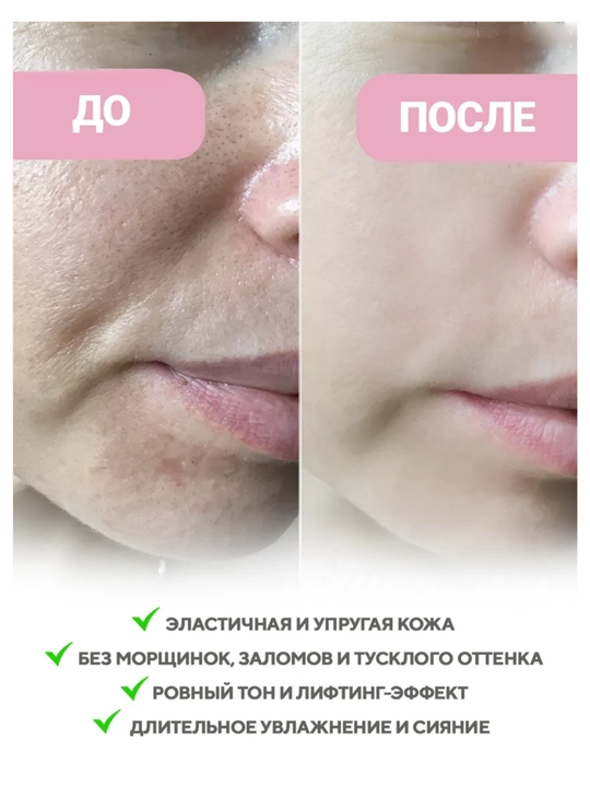 Гидрогелевая и тканевая маска с микроиглами VT Cosmetics, PDRN, ретинол, коллаген, лифтинг