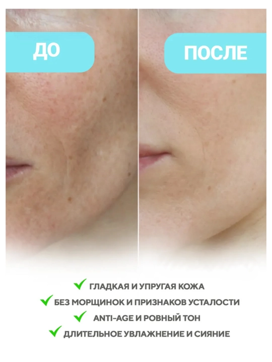 Гидрогелевая и тканевая маска с микроиглами VT Cosmetics, PDRN, ретинол, коллаген, лифтинг