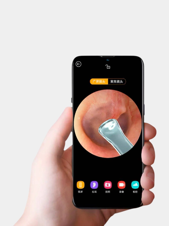 Xiaomi Bebird R1 uchida o'rnatilgan kamerali aqlli quloq tozalagich