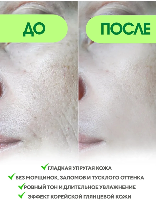 Гидрогелевая и тканевая маска с микроиглами VT Cosmetics, PDRN, ретинол, коллаген, лифтинг