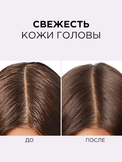 Zardob L'Oreal Paris Elseve ''Hyaluron Pure'', yog'li bosh terisi uchun, 102 ml