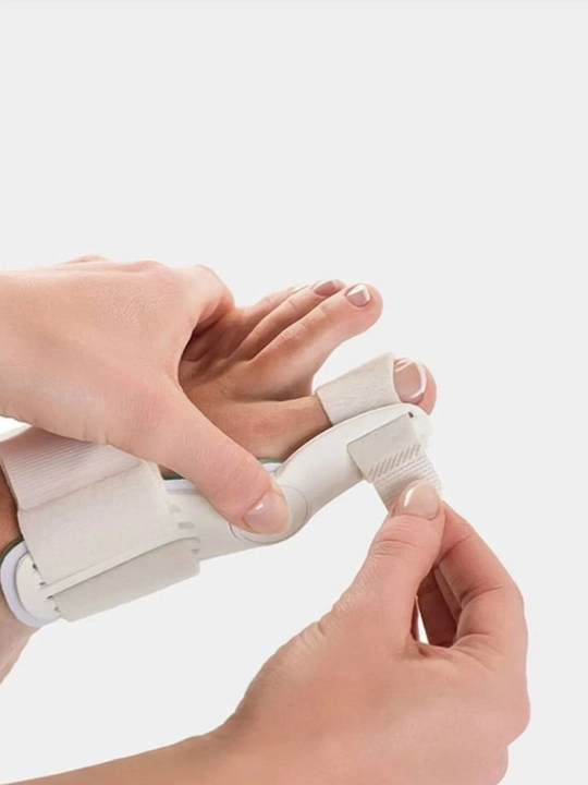 Oyoqning bosh barmog'i uchun valgus nayzasi fiksatori Nallux Valgus, 1 dona