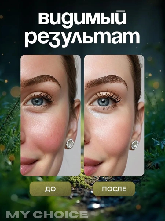 Kosmetik ilon moyi sovuni ajinlar, akne va xusunbuzarlarga qarshi oqartiruvchi 3 tasi 1 da