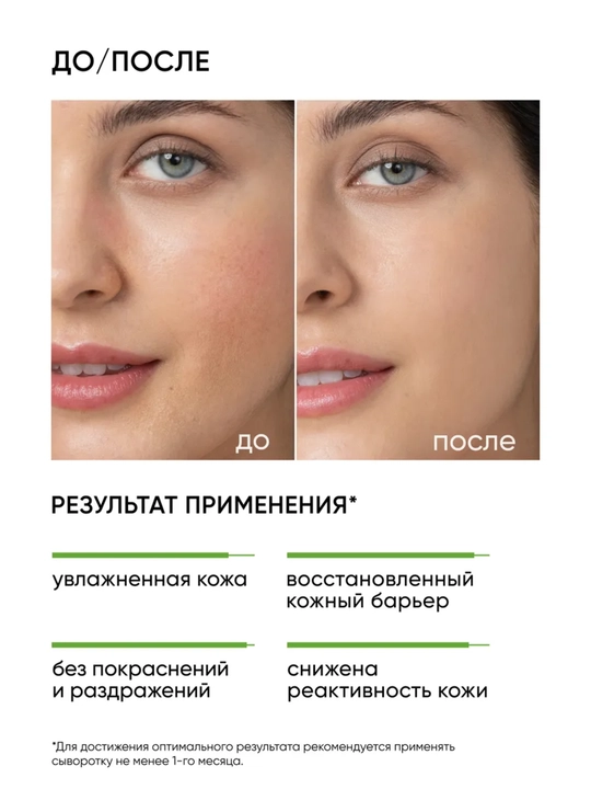 Успокаивающая сыворотка-концентрат для лица ICON SKIN, успокаивающая с центеллой, 30 мл