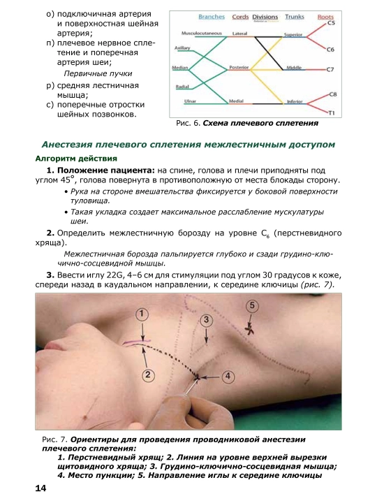 Проводниковая анестезия: алгоритмы поиска и действия