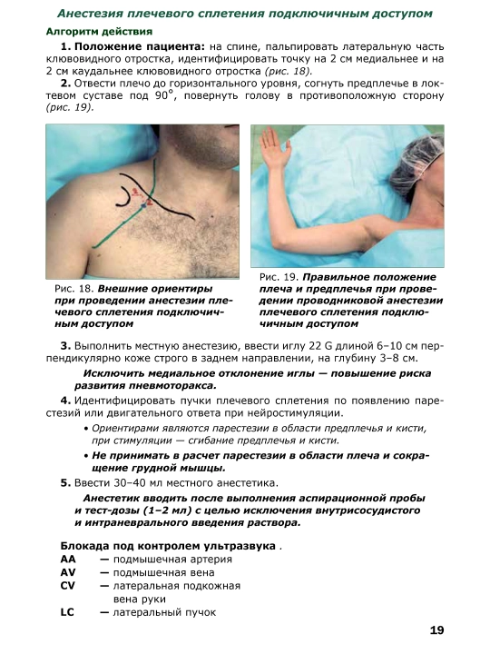 Проводниковая анестезия: алгоритмы поиска и действия