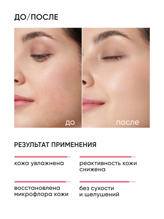 Tinchlantiruvchi krem pre- va probiotiklar kompleksi bilan ICON SKIN SensiCare, 30 ml