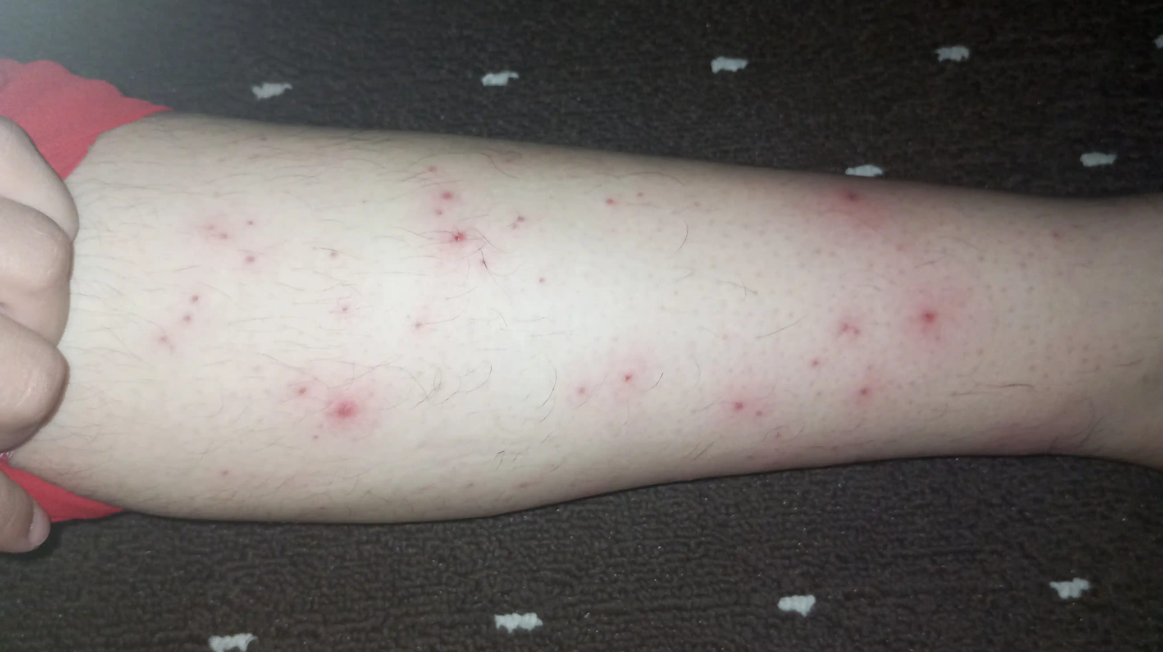 Loson depilyatsiyadan oldin va shugaring uchun terini tayyorlash 100 ml Sweet Moments