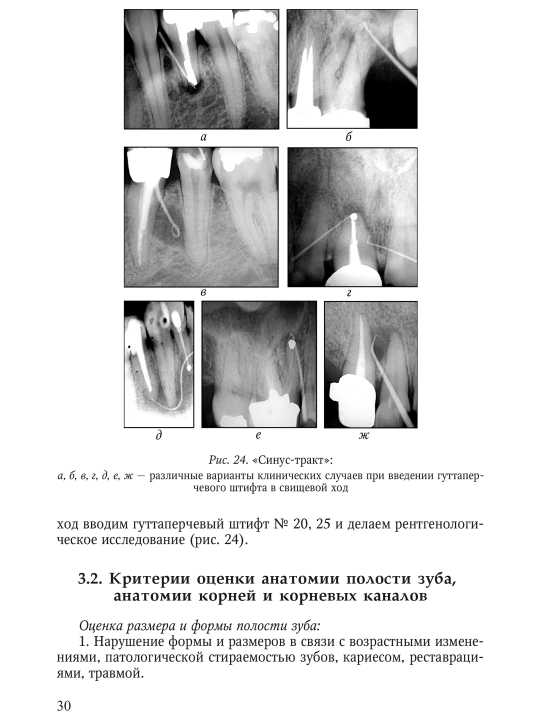 Sovremennyye podkhody k endodonticheskomu lecheniyu zubov