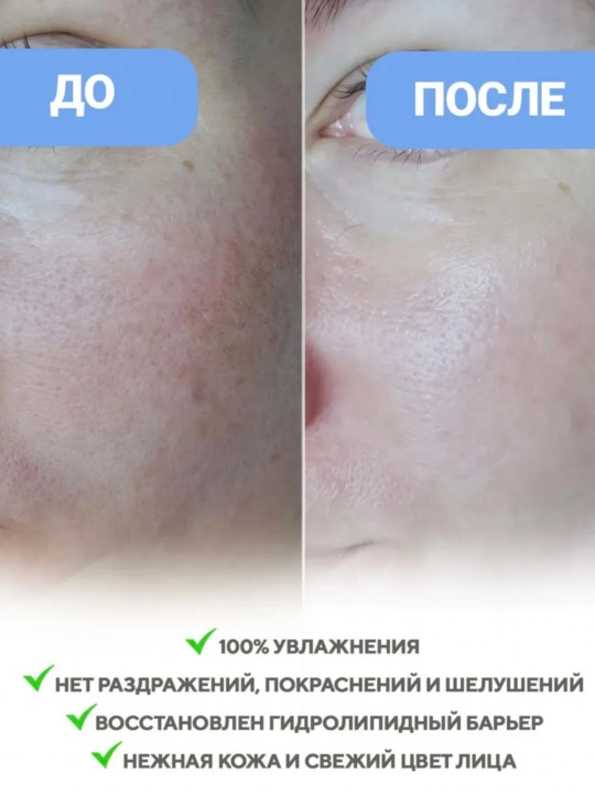 Гелевые тонер-пэды Biodance - нежный уход, мощное увлажнение и сияние кожи