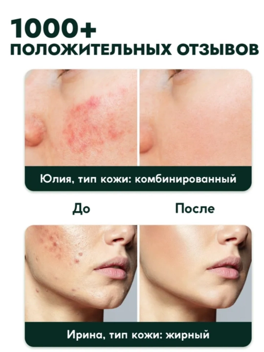 Сыворотка для лица от прыщей и черных точек SEMILYот морщин, антивозрастная 30 мл