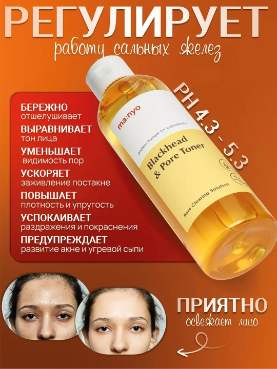 Тонер для лица, Manyo, Galactomy Clearskin, Blackhead & Pore, Galac Whitening Vita