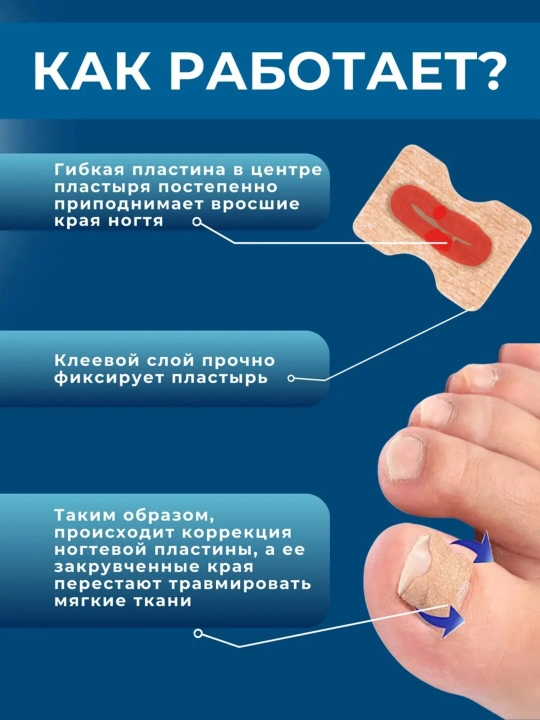 Корректор от вросших ногтей с защитными наклейками для педикюра
