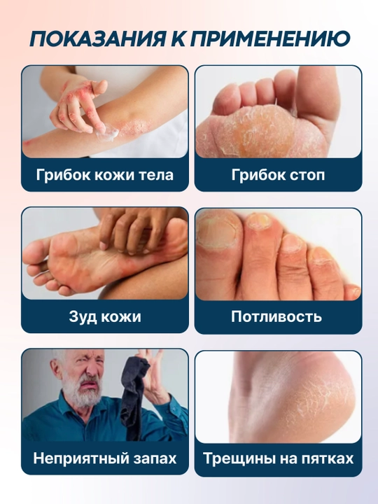 Противогрибковый крем для тела Cutis Cream 30gm