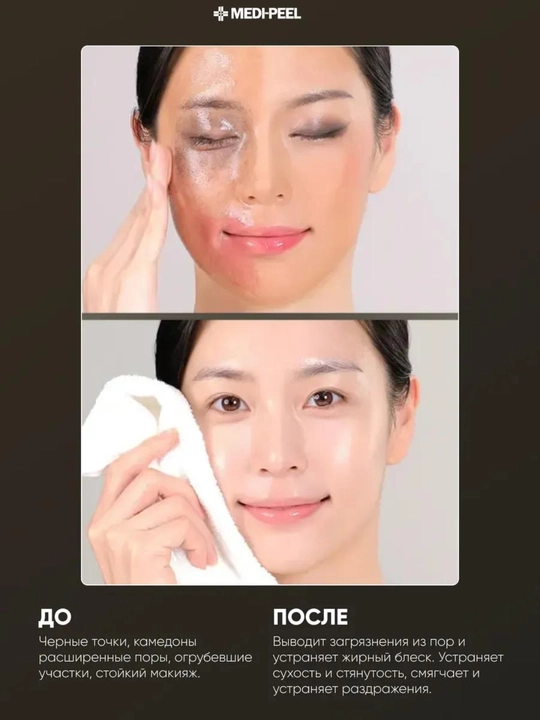Крем-Бустер с микроиглами и ретинолом Vita-A RetinAl Shot ретинал  Сыворотка  15 мл, 30 мл