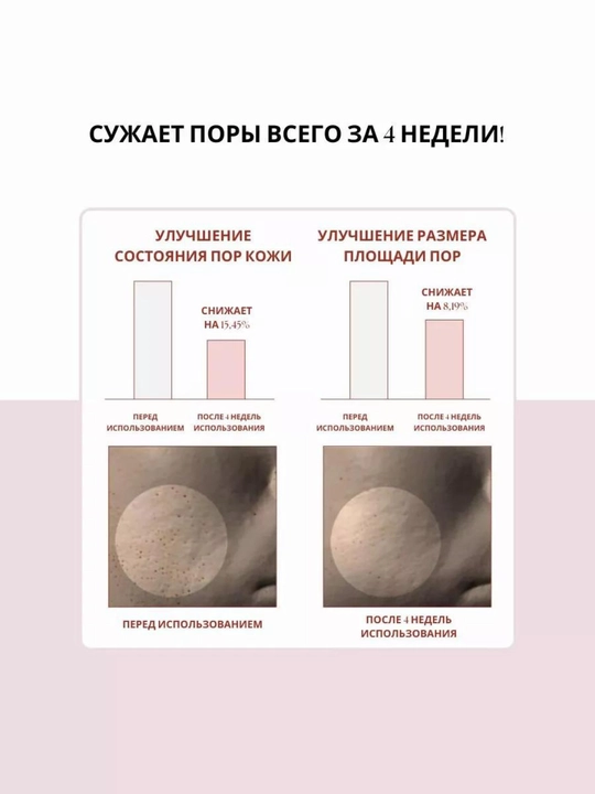 Крем для сужения пор Centella skin1004, сыворотка, гель для умывания, тоник для лица