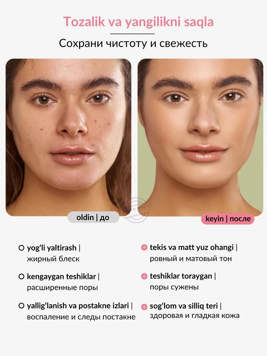 Тоник с ниацинамидом для лица MIXIT Niacinamide Face Tonic, 150 мл