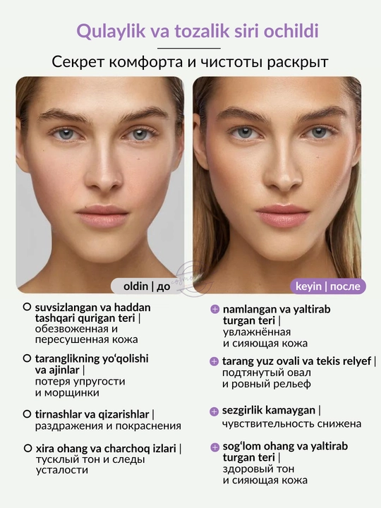 Увлажняющий тоник для лица MIXIT Hydra Face Tonic, 150 мл