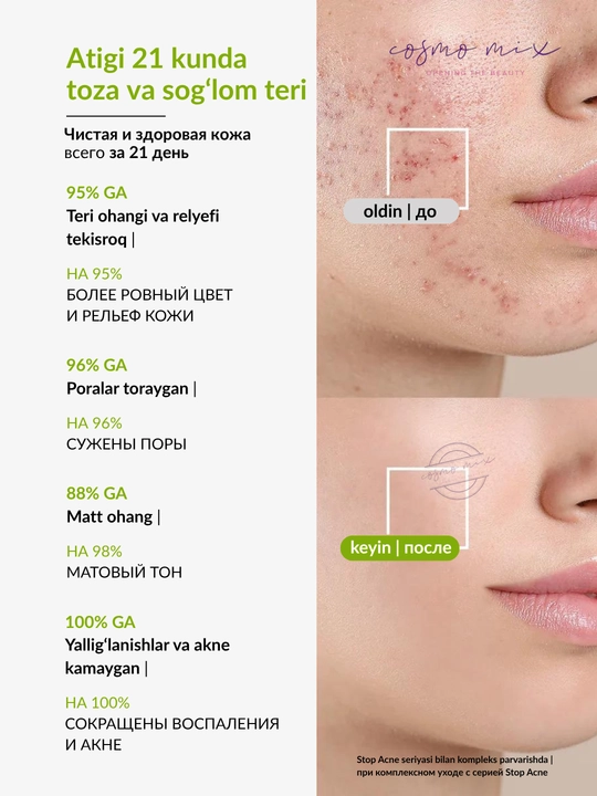 MIXIT Stop Acne yuz uchun aknega qarshi tozalovchi tonik, 150 ml