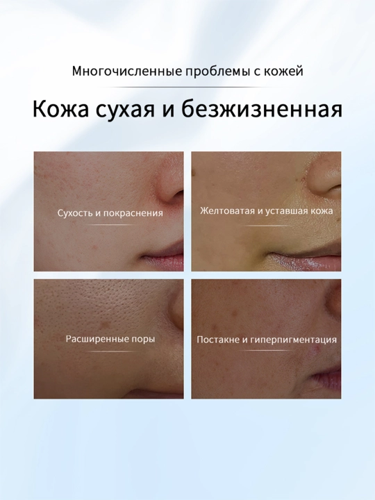 Увлажняющая маска LYDIMOON, омолаживающая, увлажняющая, осветляющая кожу