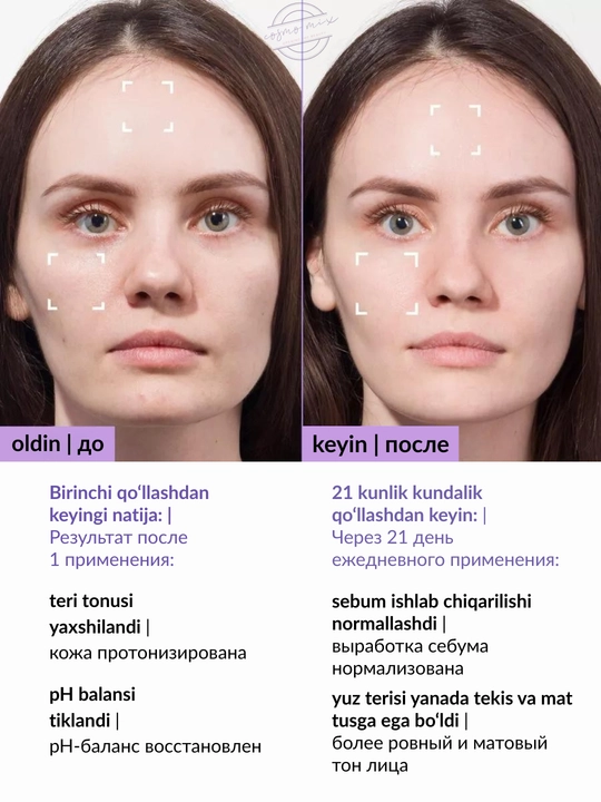 Тоник с ниацинамидом и цинком для жирной кожи MIXIT LAB Hyaluron Matte Skin, 250 мл
