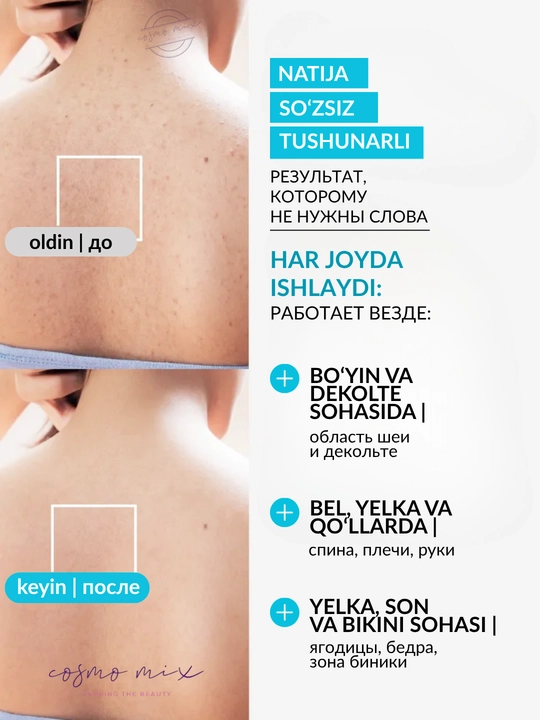Саморегулирующая сыворотка с ниацинамидом и цинком MIXIT Anti-Blemish Serum, 30 мл