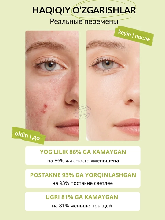 Саморегулирующая сыворотка с ниацинамидом и цинком MIXIT Anti-Blemish Serum, 30 мл