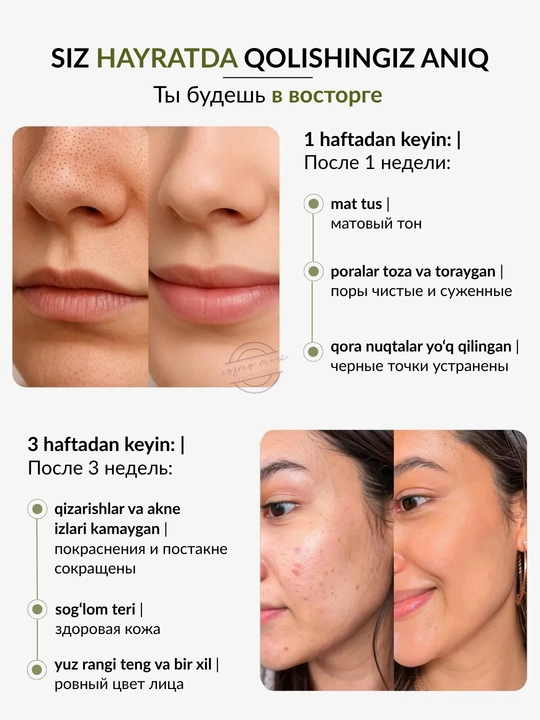 MIXIT Niacinamide tozalovchi va matli yuz yuvish geli, 250 ml