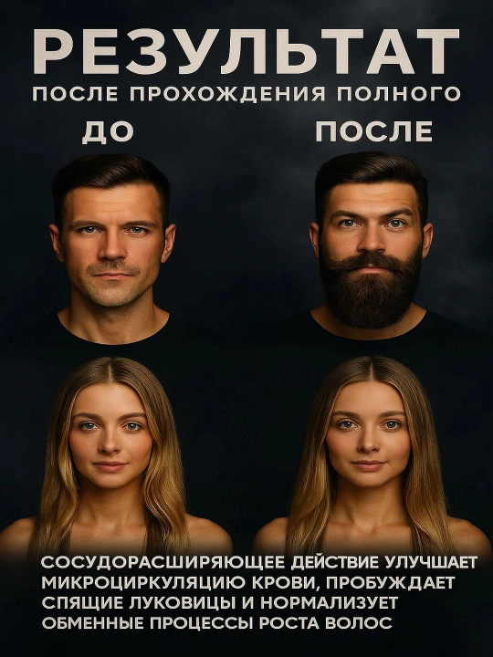 Миноксидил 10%,12.5% + мезороллер, средство против выпадения волос, активатор роста, 60 мл