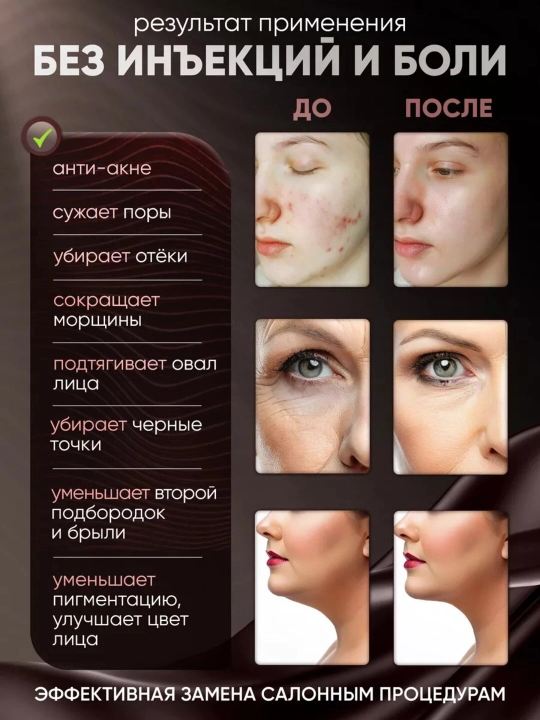 Микротоковый массажер для лица профессиональная чистка RF, EMS, LED, лифтинг уход за кожей