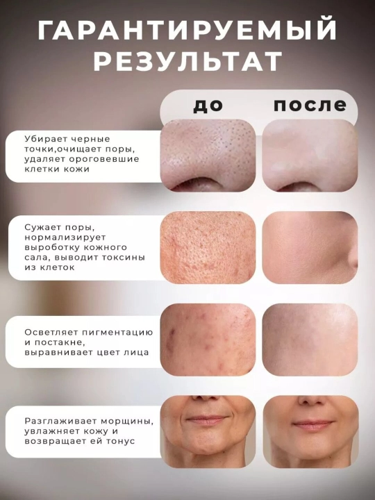 Массажер для лица шеи, микротоковый, электрический, от отеков