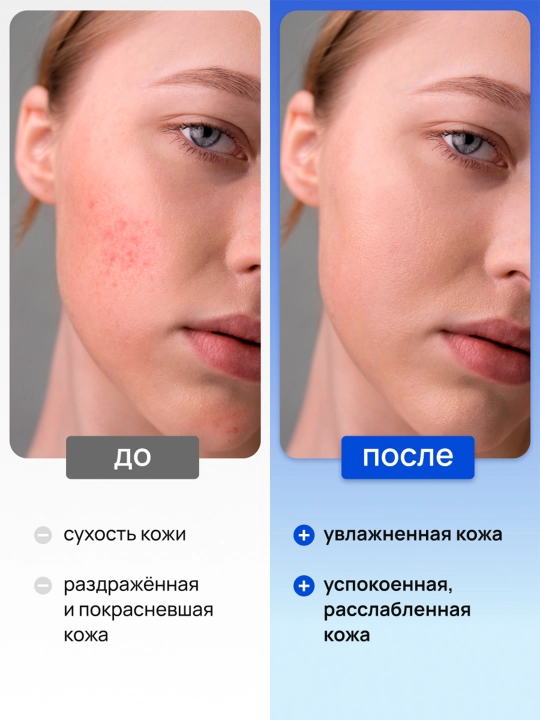 Сыворотка для лица увлажняющая 3 в 1 с гиалуроновой кислотой Deonica Skincare line 30 мл