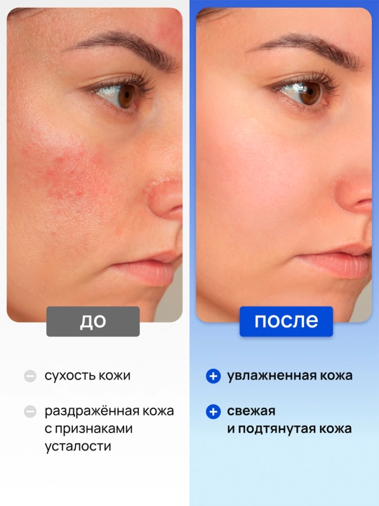 Тоник для лица 5 в 1 увлажняющий и очищающий для всех типов кожи Deonica Skincare line 200 мл