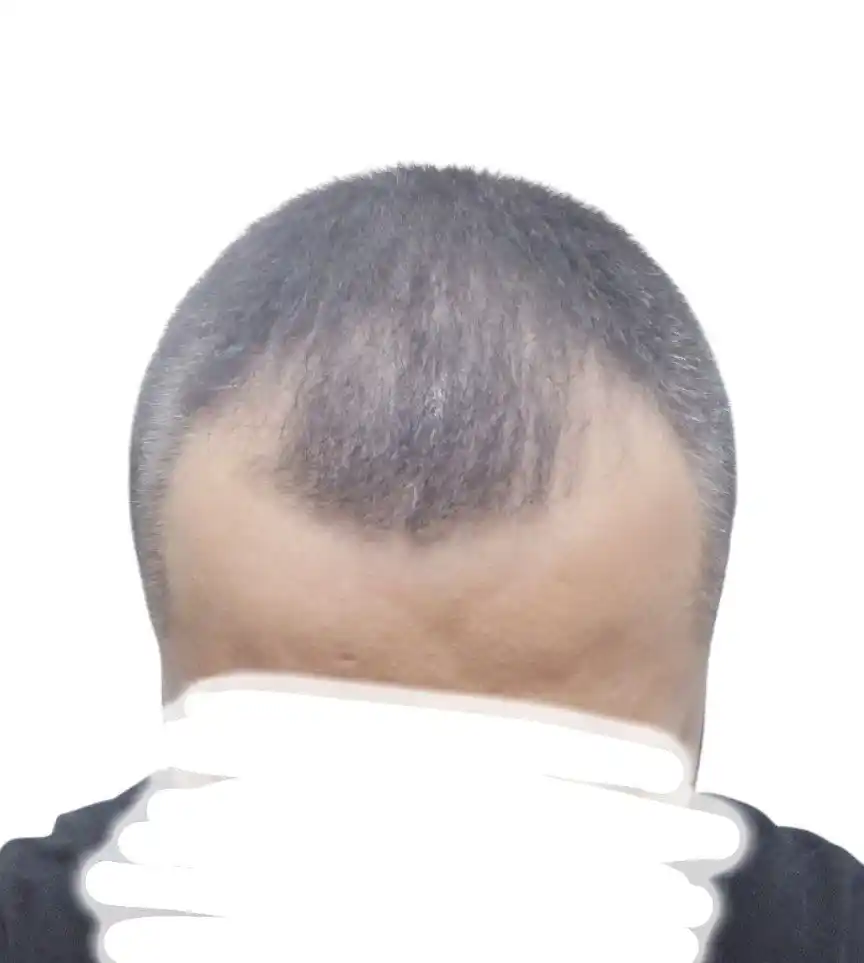 Пудра загуститель для волос Dexe Hair Building Fibers