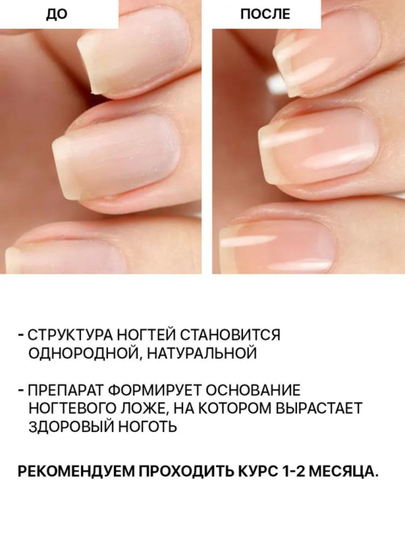 FRENCHI, Лак для ногтей, прозрачный, увлажняющий гель-укрепитель, 11 мл