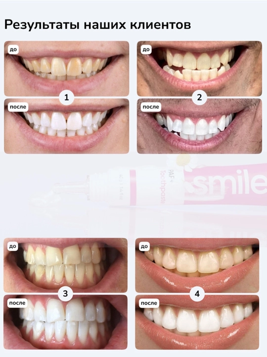 Smilebe Отбеливающая зубная паста PAP+ — безопасное щадящее отбеливание, 40 г