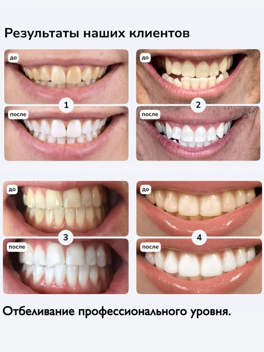 Smilebe Pro Formula Отбеливающие полоски — профессиональное отбеливание зубов, 28 шт