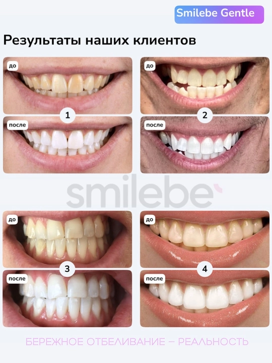 Smilebe PAP+ Gentle отбеливающие полоски — бережное отбеливание, 28 шт
